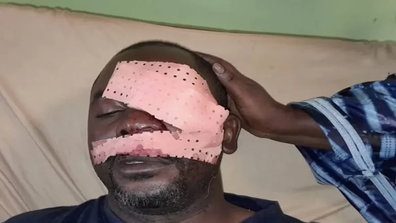 À Bomboly, dans la banlieue de Conakry, le journaliste sportif Daouda Bah a été violemment agressé par des individus non identifiés. L’événement relance le débat sur la sécurité des professionnels des médias en Guinée, dans un climat marqué par l’impunité.